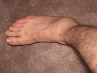 198Ankle_002.jpg